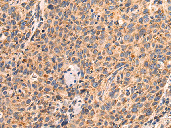 Anti-MRPS36 Rabbit Polyclonal Antibody