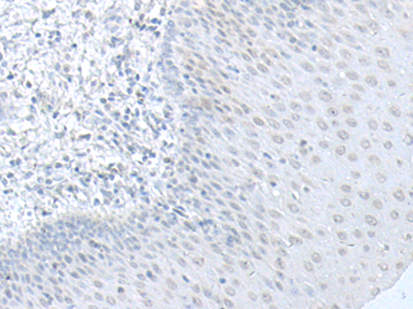 Anti-C8orf4 Rabbit Polyclonal Antibody