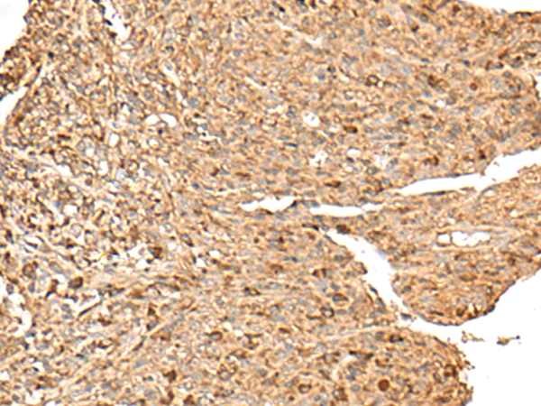 Anti-RPS12 Rabbit Polyclonal Antibody