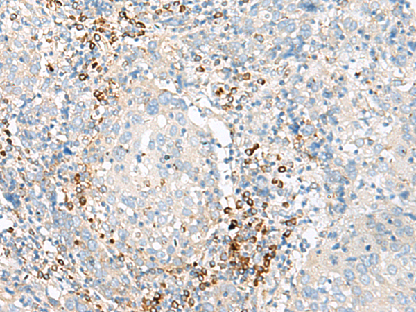Anti-Fetal Hemoglobin Rabbit Polyclonal Antibody