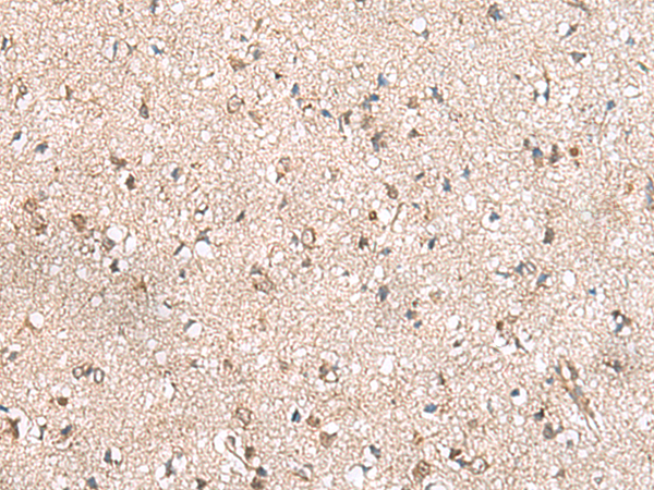 Anti-RPL23A Rabbit Polyclonal Antibody