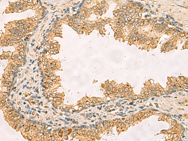 Anti-RPS11 Rabbit Polyclonal Antibody
