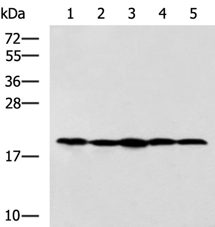 Anti-RPS11 Rabbit Polyclonal Antibody