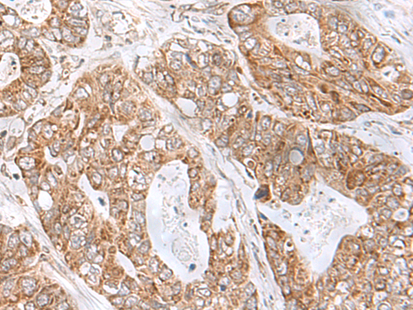 Anti-C8orf44 Rabbit Polyclonal Antibody