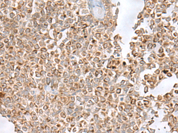 Anti-GLYAT Rabbit Polyclonal Antibody