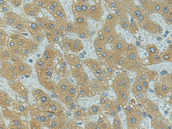 Anti-RPL17 Rabbit Polyclonal Antibody