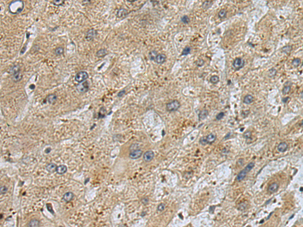 Anti-SRI Rabbit Polyclonal Antibody