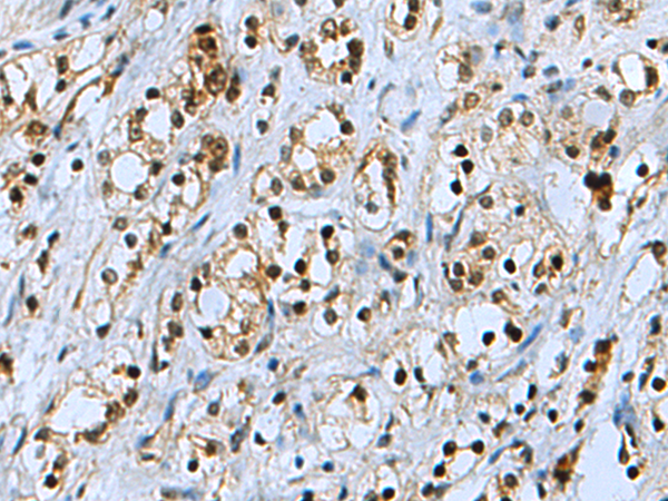 Anti-PSMB3 Rabbit Polyclonal Antibody