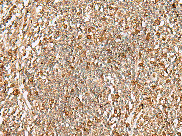 Anti-DTYMK Rabbit Polyclonal Antibody