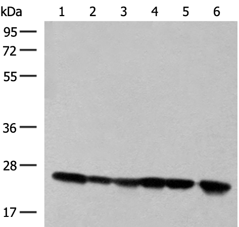 Anti-DTYMK Rabbit Polyclonal Antibody