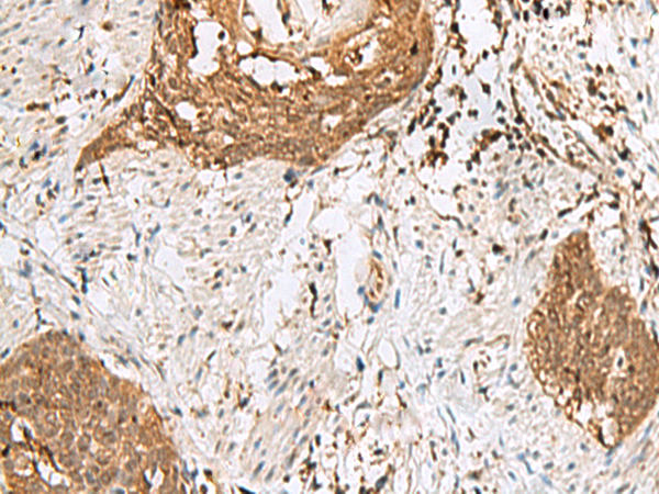 Anti-PCTP Rabbit Polyclonal Antibody