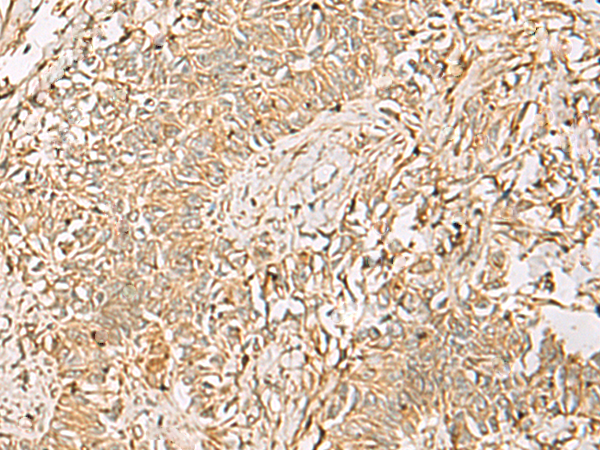 Anti-QDPR Rabbit Polyclonal Antibody