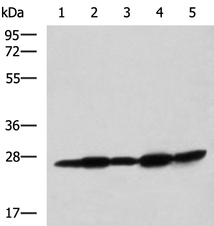 Anti-QDPR Rabbit Polyclonal Antibody