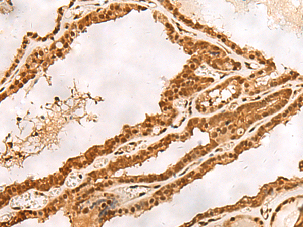 Anti-PSMA3 Rabbit Polyclonal Antibody