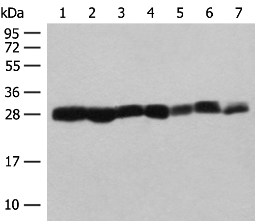 Anti-PSMA3 Rabbit Polyclonal Antibody