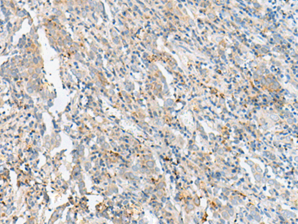 Anti-CTRB1 Rabbit Polyclonal Antibody