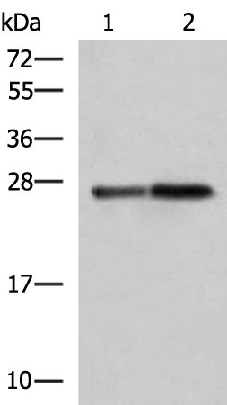 Anti-CTRB1 Rabbit Polyclonal Antibody