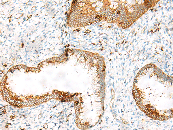 Anti-HLA DRB1 Rabbit Polyclonal Antibody