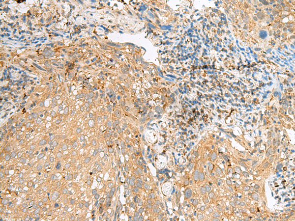 Anti-COPE Rabbit Polyclonal Antibody