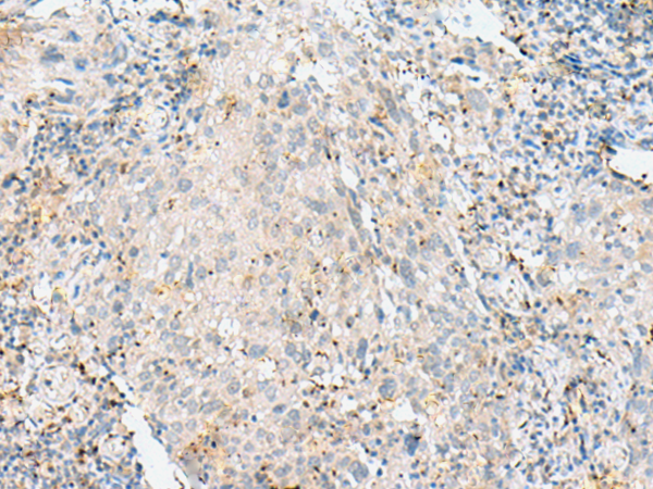 Anti-NSUN4 Rabbit Polyclonal Antibody