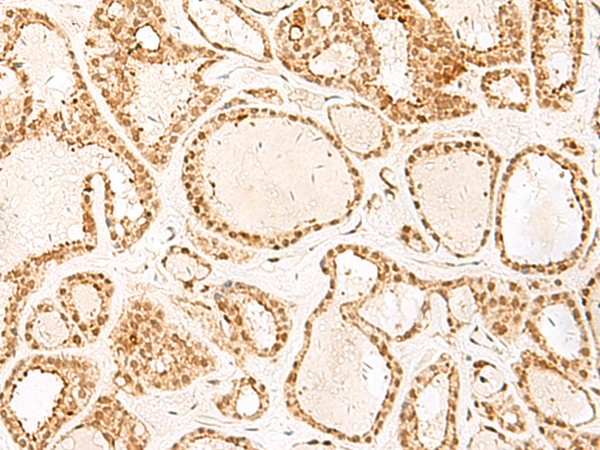 Anti-PSPC1 Rabbit Polyclonal Antibody
