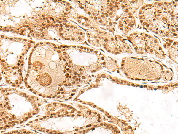 Anti-POLH Rabbit Polyclonal Antibody
