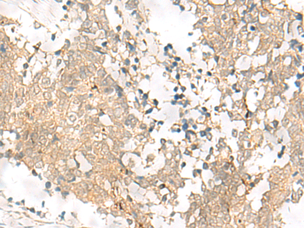 Anti-GPSM1 Rabbit Polyclonal Antibody