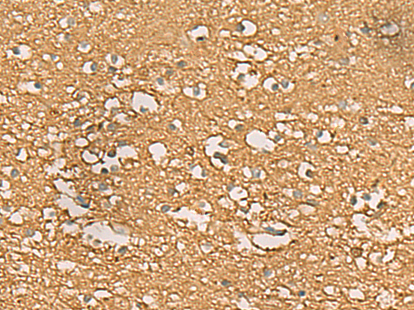 Anti-ENO3 Rabbit Polyclonal Antibody