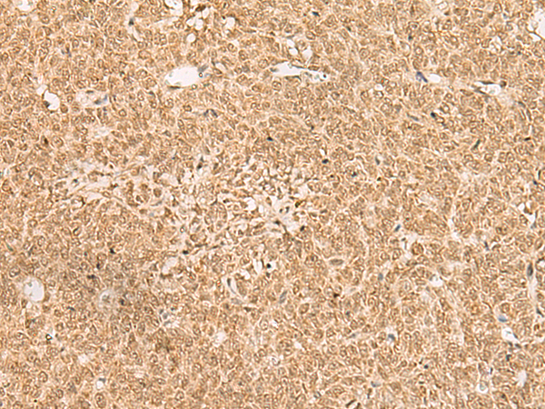 Anti-EXD2 Rabbit Polyclonal Antibody