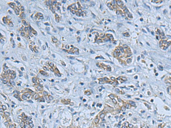Anti-LPCAT2 Rabbit Polyclonal Antibody