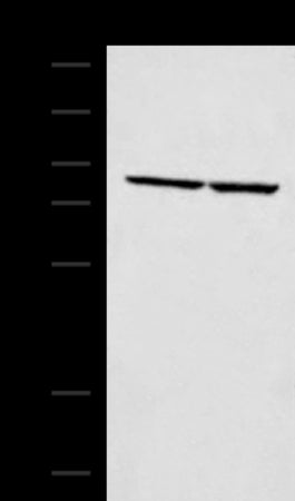 Anti-ABLIM3 Rabbit Polyclonal Antibody