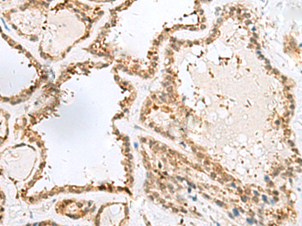 Anti-ECD Rabbit Polyclonal Antibody