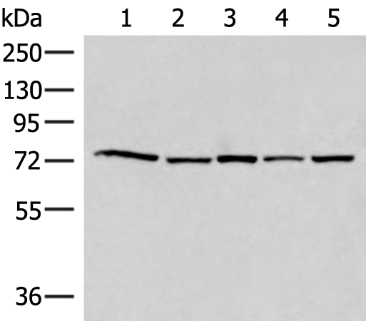 Anti-ATMIN Rabbit Polyclonal Antibody