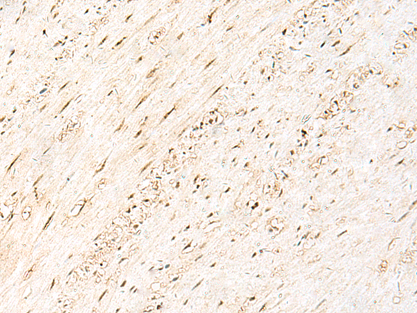 Anti-PRPF3 Rabbit Polyclonal Antibody