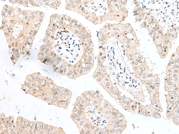 Anti-NGEF Rabbit Polyclonal Antibody