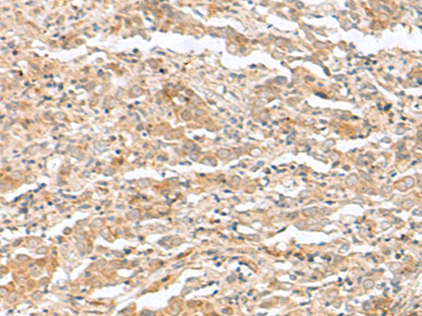 Anti-TPR Repeat Protein 12 Rabbit Polyclonal Antibody