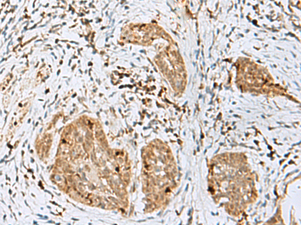 Anti-TEX11 Rabbit Polyclonal Antibody