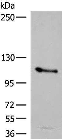 Anti-AP2B1 Rabbit Polyclonal Antibody