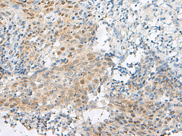 Anti-DHX36 Rabbit Polyclonal Antibody