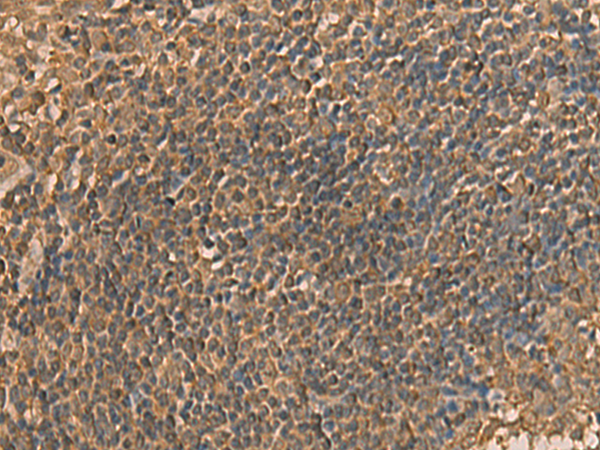 Anti-RPL34 Rabbit Polyclonal Antibody