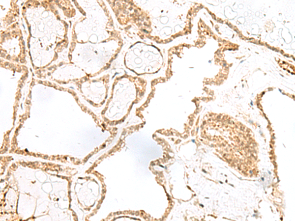 Anti-RPP14 Rabbit Polyclonal Antibody