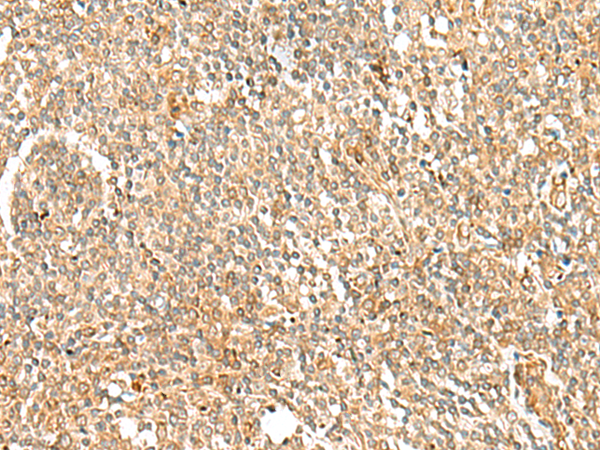 Anti-LMO3 Rabbit Polyclonal Antibody