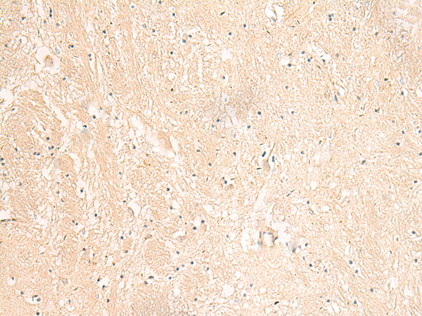 Anti-PPP1R1A Rabbit Polyclonal Antibody