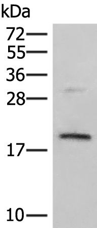 Anti-PPP1R1A Rabbit Polyclonal Antibody