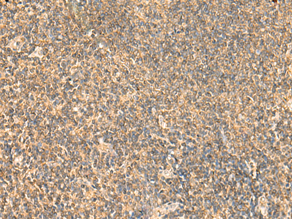 Anti-PDAP1 Rabbit Polyclonal Antibody