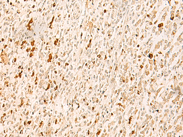 Anti-TBP Like 1 Rabbit Polyclonal Antibody