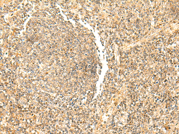 Anti-DHFR Rabbit Polyclonal Antibody
