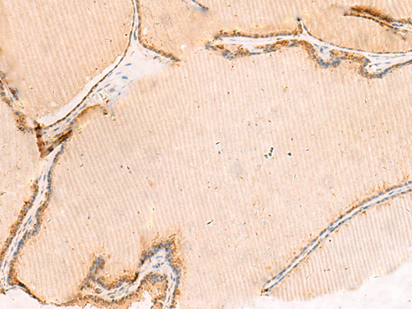 Anti-DNAJC12 Rabbit Polyclonal Antibody