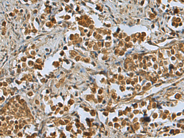 Anti-PSMB2 Rabbit Polyclonal Antibody