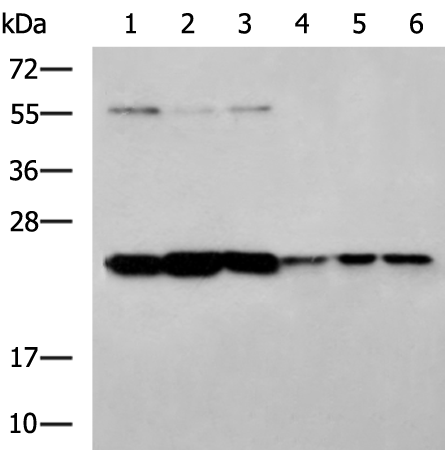 Anti-PSMB2 Rabbit Polyclonal Antibody